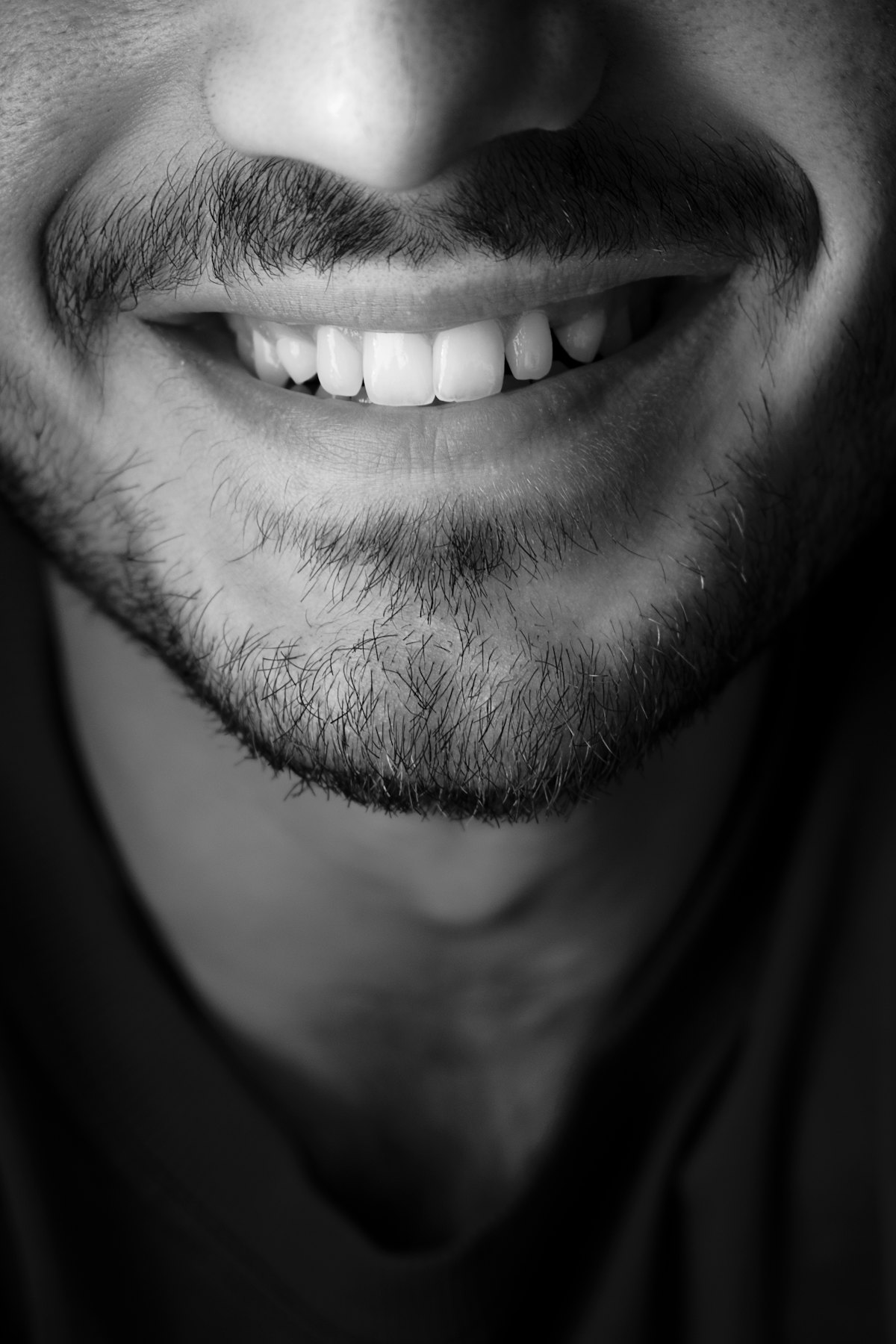 Before Smile Designing at Make Me Smile Dental Health Center