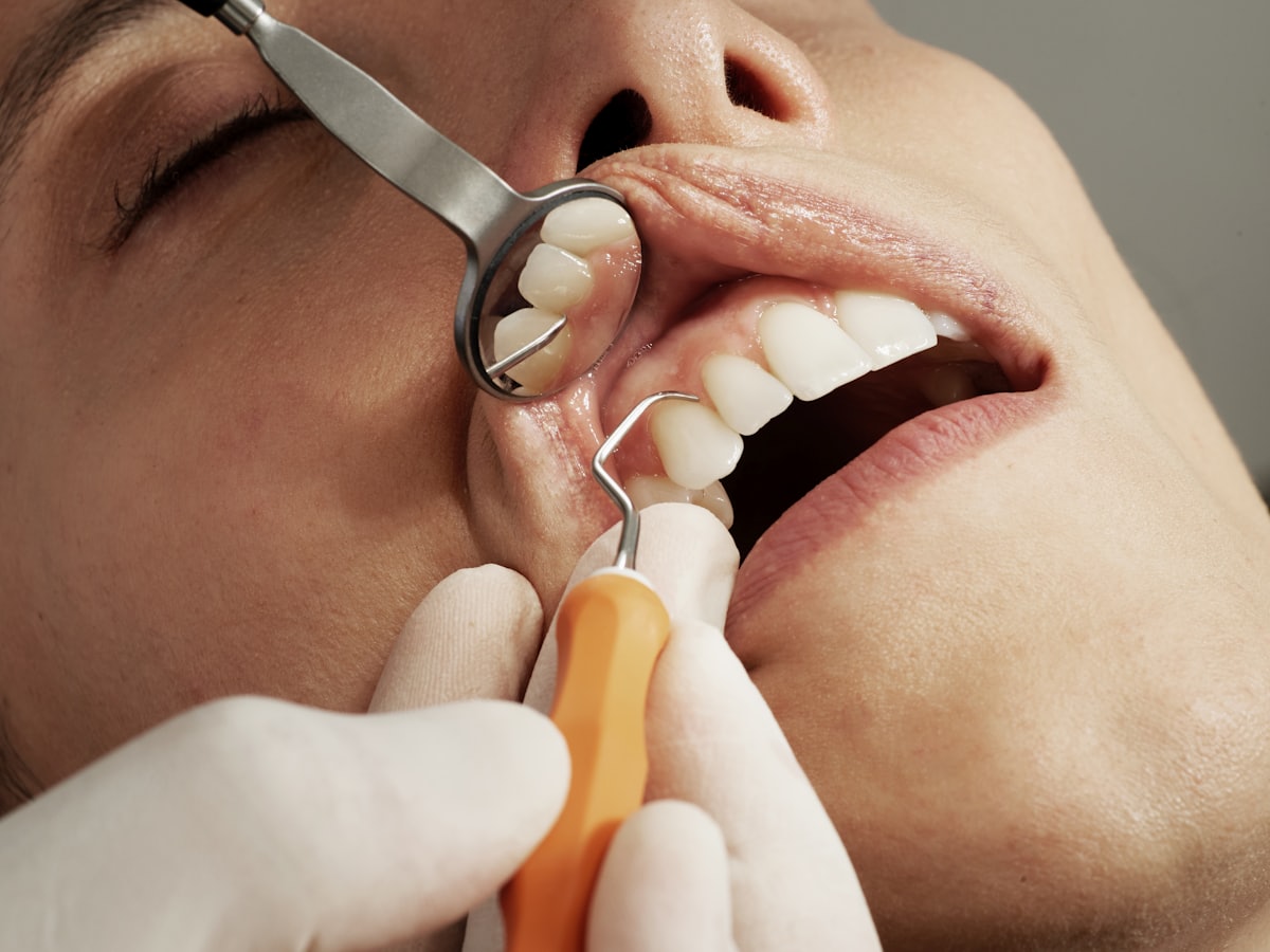 Root Canal Treatment