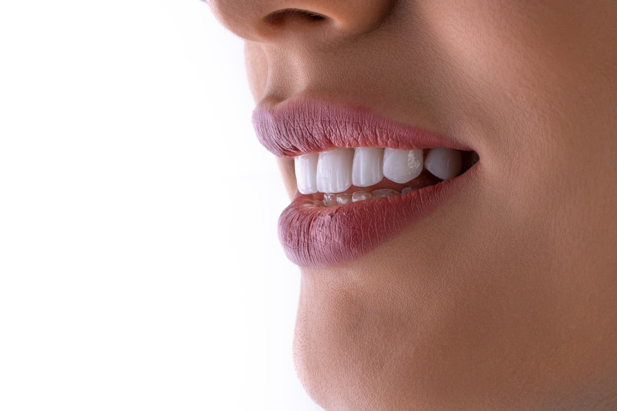 After Smile Designing at Make Me Smile Dental Health Center